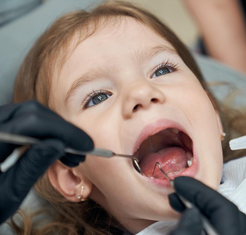 sigillature denti bambini