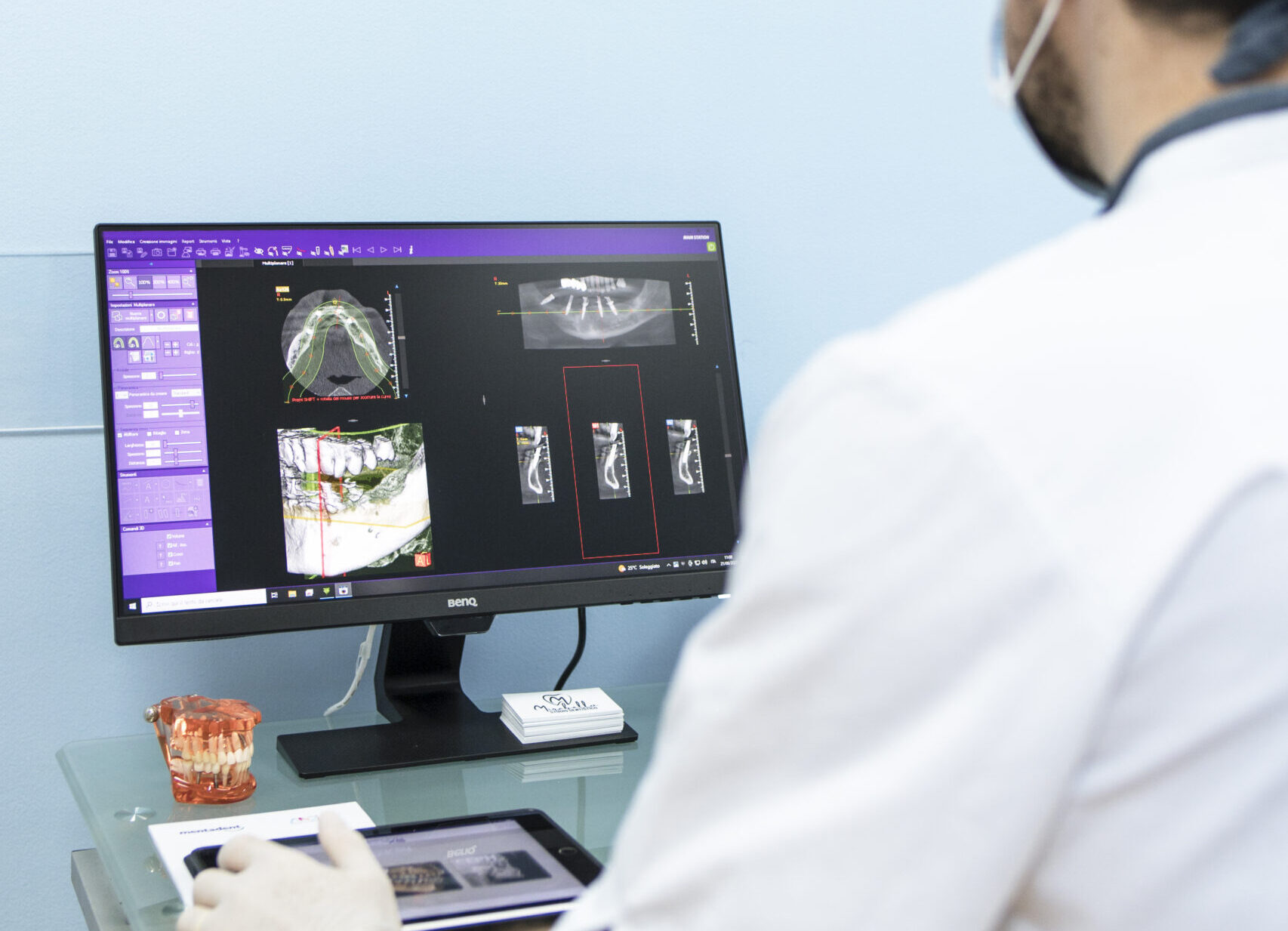 implantologia dentale ossea