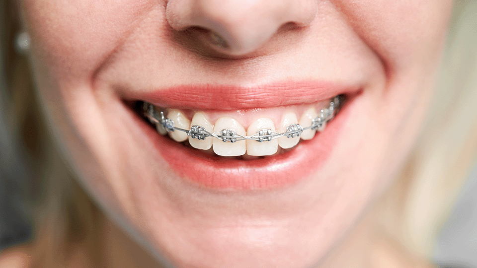 ortodonzia studio dentistico